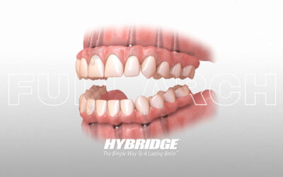 Regain Your Smile with Hybridge Full Arch Dental Implants at Michiana Dental Implants (MDI)